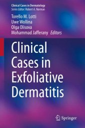 book Clinical Cases in Exfoliative Dermatitis