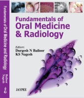 book Fundamentals of Oral Medicine and Radiology