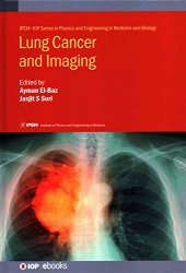 book Lung Cancer and Imaging