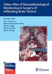 book Video Atlas of Neurophysiological Monitoring in Surgery of Infiltrating Brain Tumors