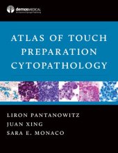 book Atlas of Touch Preparation Cytopathology by springer ,Liron Pantanowitz, MD / Juan Xing, MD / Sara E. Monaco, MD