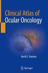 book Clinical Atlas of Ocular Oncology