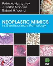 book Neoplastic Mimics in Genitourinary Pathology