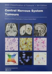 book Who Classification of Tumours - Central Nervous System Tumours