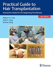 book Practical Guide to Hair Transplantation: Interactive Study for the Beginning Practitioner