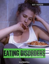 book Eating Disorders: When Food Is an Obsession