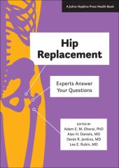 book Hip Replacement: Experts Answer Your Questions