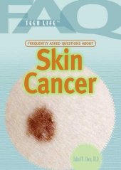 book Frequently Asked Questions about Skin Cancer