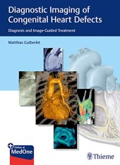 book Diagnostic Imaging of Congenital Heart Defects: Diagnosis and Image-Guided Treatment