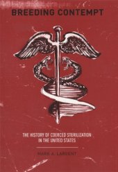 book Breeding Contempt: The History of Coerced Sterilization in the United States