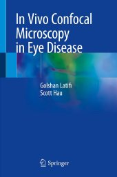 book In Vivo Confocal Microscopy in Eye Disease