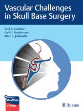 book Vascular Challenges in Skull Base Surgery