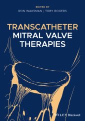 book Transcatheter Mitral Valve Therapies