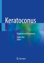 book Keratoconus: Diagnosis and Treatment