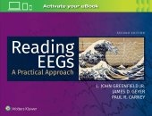 book Reading EEGs: A Practical Approach