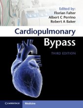 book Cardiopulmonary Bypass