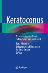 book Keratoconus: A Comprehensive Guide to Diagnosis and Treatment