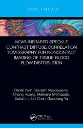 book Near-infrared Speckle Contrast Diffuse Correlation Tomography for Noncontact Imaging of Tissue Blood Flow Distribution