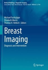 book Breast Imaging: Diagnosis and Intervention