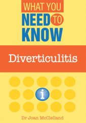 book Diverticulitis