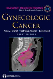 book Gynecologic Cancer (Radiation Medicine Rounds, Volume 2, Issue 3)