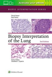 book Biopsy Interpretation of the Lung