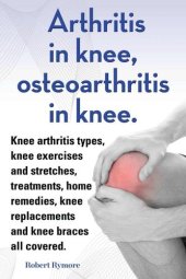 book Arthritis in knee, osteoarthritis in knee. Knee arthritis exercises and stretches, treatments, home remedies, knee replacements and knee braces all covered.