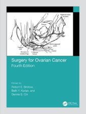 book Surgery for Ovarian Cancer