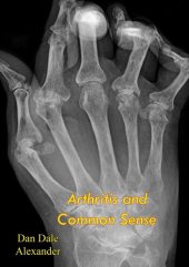 book Arthritis and Common Sense