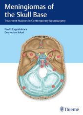 book Meningiomas of the Skull Base: Treatment Nuances in Contemporary Neurosurgery