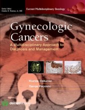 book Gynecologic Cancers A. Multidisciplinary Approach to Diagnosis and Management