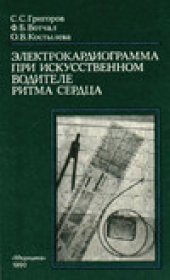 book Электрокардиограмма при искусственном водителе ритма сердца