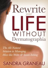 book Rewrite Your Life Without Dermatographia: The All-Natural Solution to Managing Hive-like Welts and Severe Itching