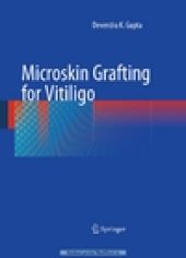 book Microskin Grafting for Vitiligo