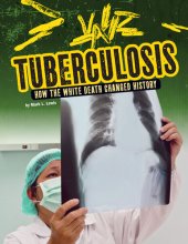 book Tuberculosis: How the White Death Changed History