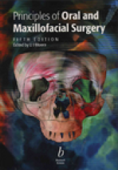 book Principles of Oral and Maxillofacial Surgery