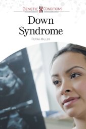 book Down Syndrome