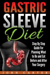 book Gastric Sleeve Diet: Step By Step Guide For Planning What to Do and Eat Before and After Your Surgery