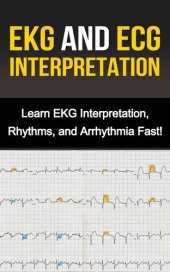 book EKG and ECG Interpretation: Learn EKG Interpretation, Rhythms, and Arrhythmia Fast!