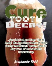 book Cure Tooth Decay!: Get the Fast and Easy Tips to Avoid the Agonizing Pains of Tooth Cavity Trouble and Totally Dismiss Any Form of Periodontitis Onset Today!