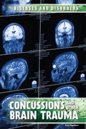 book Concussions and Other Brain Trauma