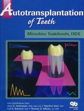 book Autotransplantation of Teeth