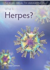 book What Is Herpes?