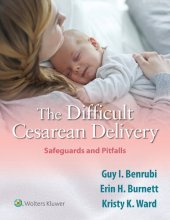 book The Difficult Cesarean Delivery: Safeguards and Pitfalls