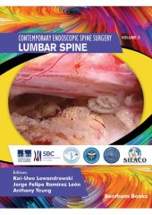 book Contemporary Endoscopic Spine Surgery, Volume 2: Lumbar Spine