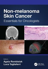 book Non-melanoma Skin Cancer: Essentials for Oncologists