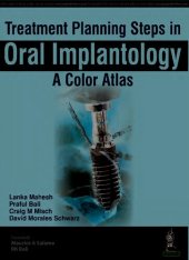 book Treatment Planning Steps in Oral Implantology: A Color Atlas