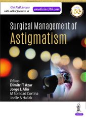 book SURGICAL MANAGEMENT OF ASTIGMATISM