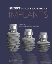 book Short and Ultra-Short Implants