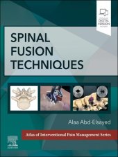 book Spinal Fusion Techniques